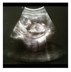 Best Free Pregnancy Apps
